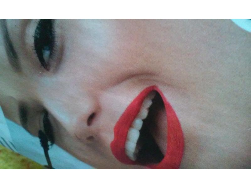kep