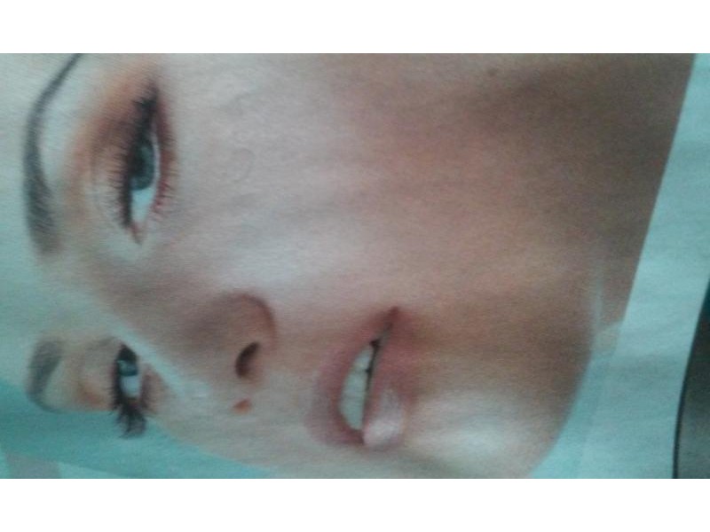 kep