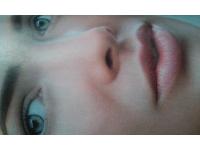 kep